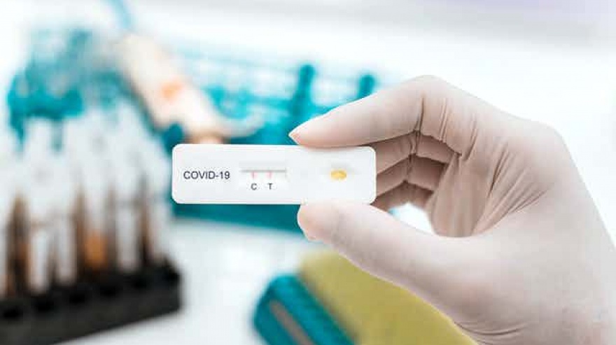 Solicitan que el Estado regule el precio de los test de Covid