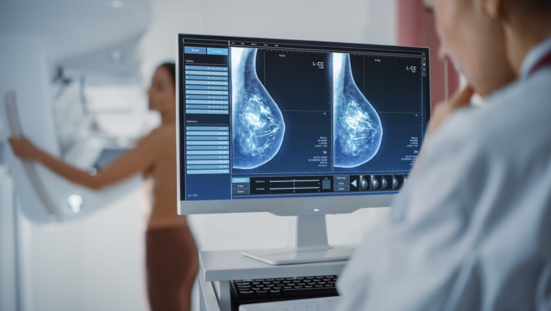 Hospitales bonaerenses realizarán “la noche de las mamografías”