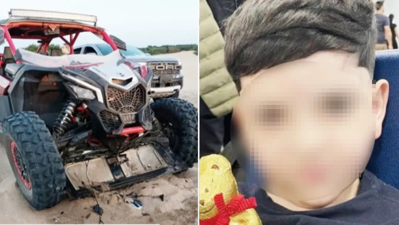 Pinamar: el niño que sufrió un fuerte golpe en el hígado en un choque en La Frontera sigue grave