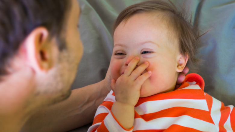 Diputados presentan iniciativas legislativas para mejorar el abordaje del síndrome de Down